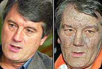 Yushchenko before and after poisoning. Source: presstv.ir